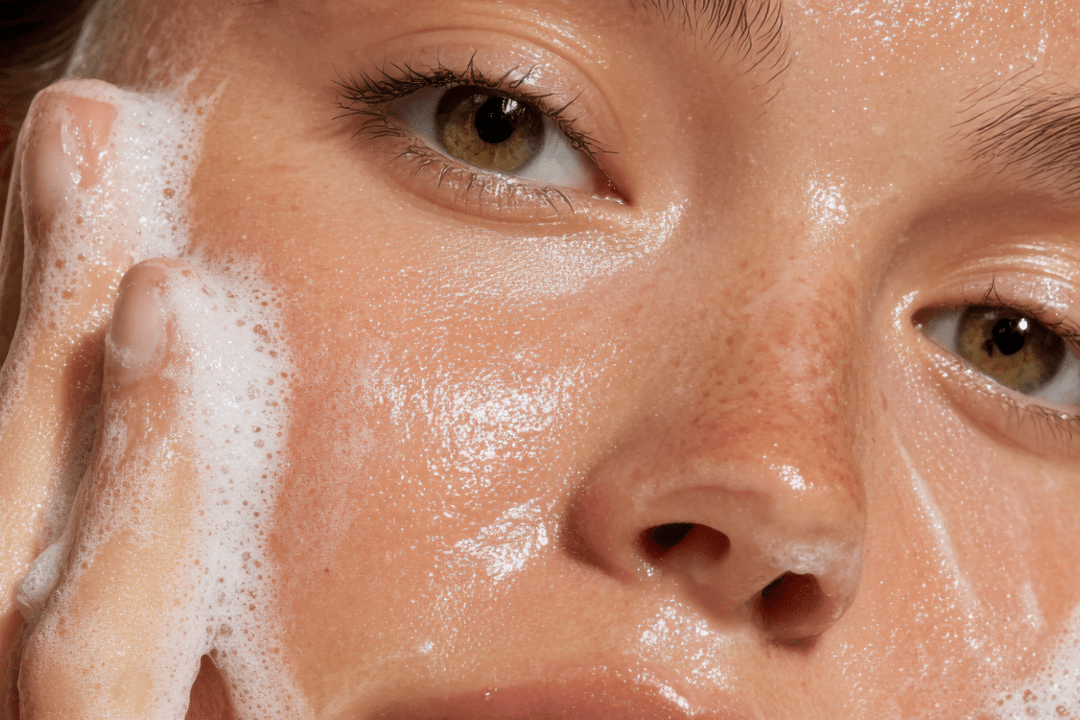 Citlivá pleť – príčiny, príznaky a kompletný návod na starostlivosť