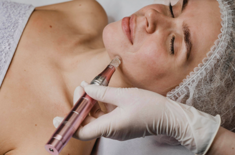 DERMAPEN – kozmetická mezoterapia